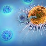 Главные преимущества лечения рака простаты в Израиле